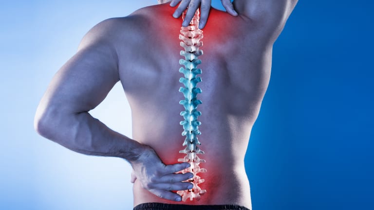 Arthritis of The Spine
