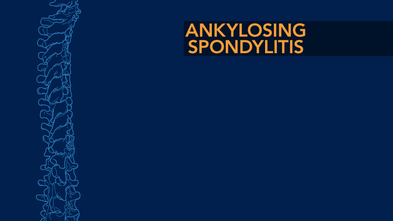 Ankylosing Spondylitis (AS)