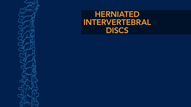 Herniated Intervertebral Discs
