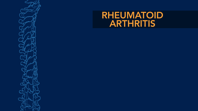 Rheumatoid Arthritis and the Spine - The Spine Community