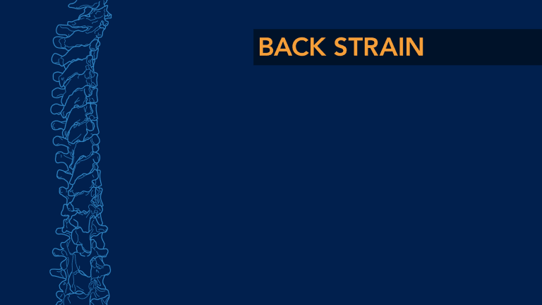 Back Strain