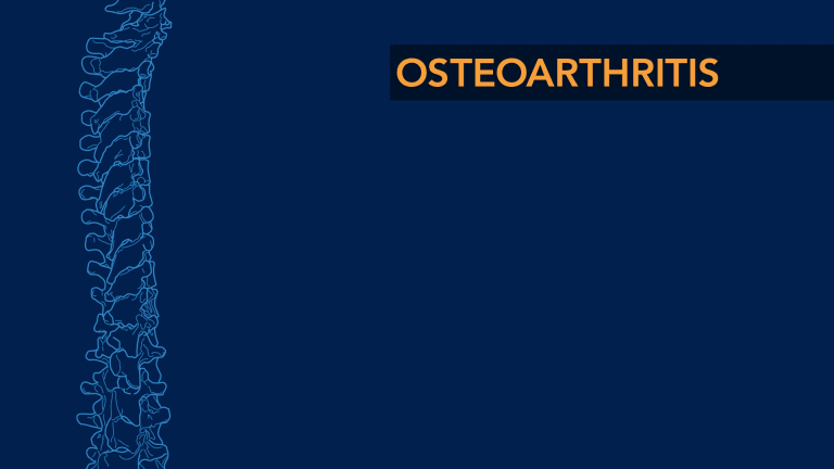 Arthritis of The Spine