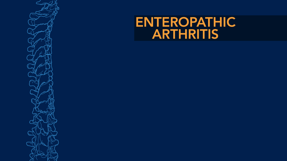 Enteropathic Arthritis The Spine Community
